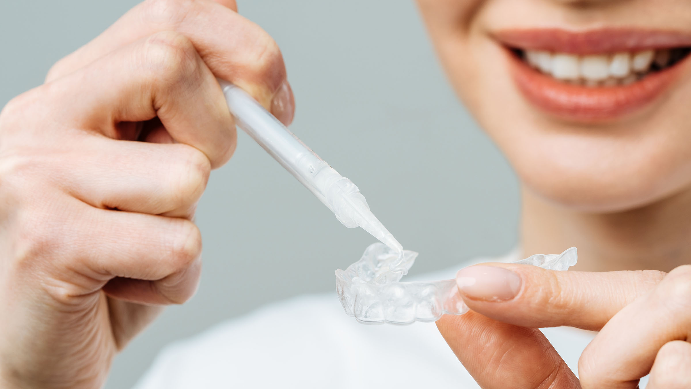 ホームホワイトニングのマウスピースの薬剤を注入している女性歯科医の写真