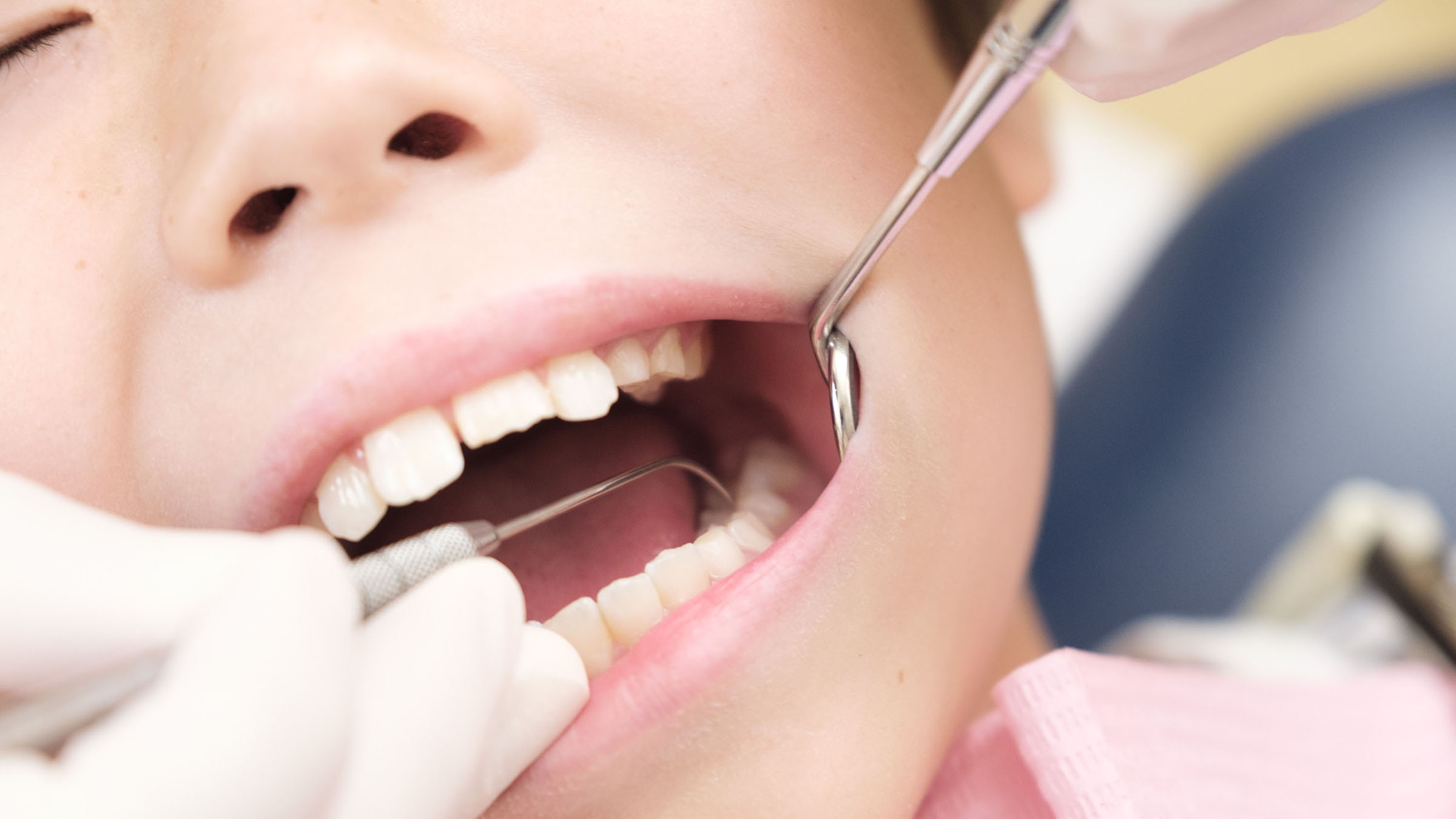 子供の歯科治療イメージ写真